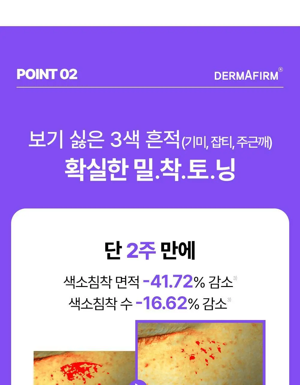 [흔적케어크림] 더마펌 수딩 리페어 토닝 크림 R4 50ml 기획 (+30ml) 상세페이지 22